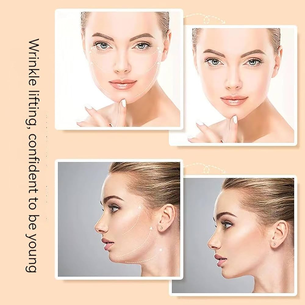 Face Lifting Device