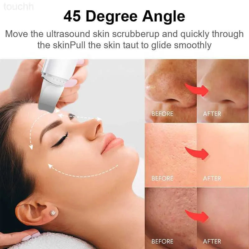Ultra sonic skin scraper
