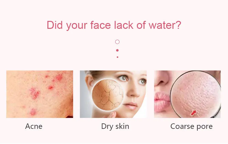 Facial Steamer NTFS