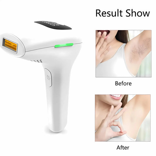 Laser Hair Remover Machine